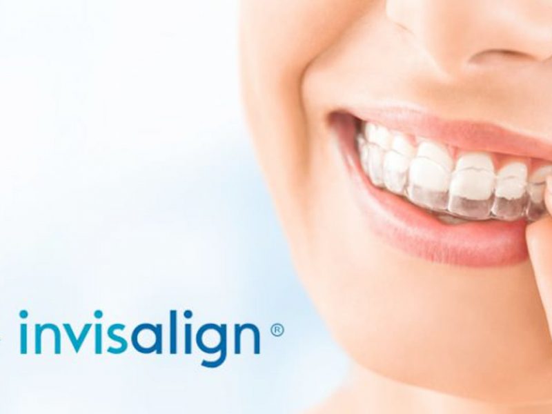 tratamiento ortodoncia invisible invisalign dentista tona