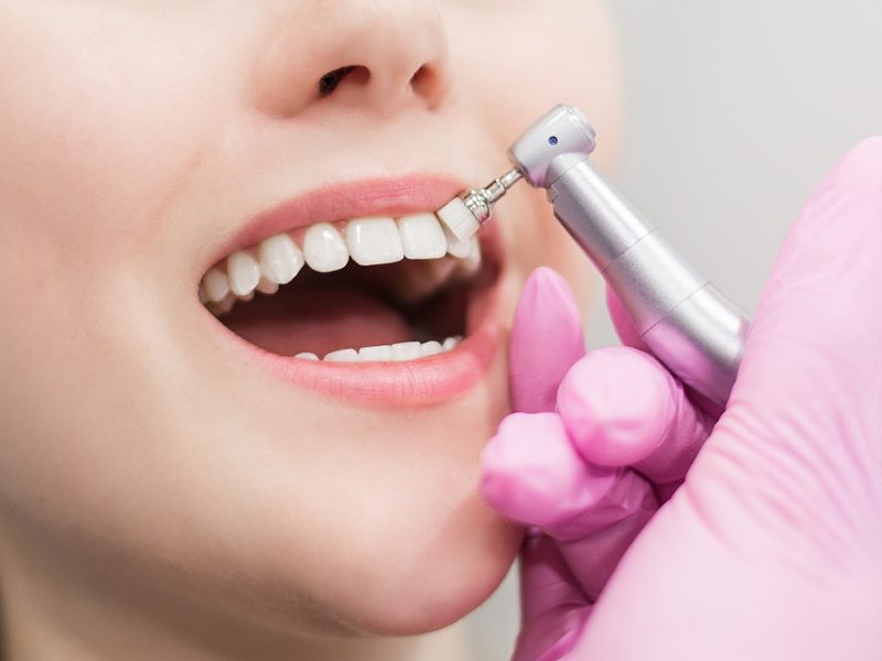 higiene dental bucal dentsita